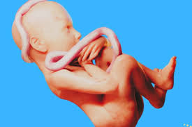 Umbilical Cord Around Neck: Spiritual Meaning, Symbolism2025
