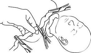 Umbilical Cord Around Neck: Spiritual Meaning, Symbolism2025