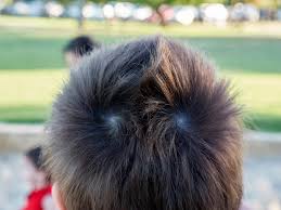 Double Crown Spiritual Meaning: Symbolism of Two Hair Whorls