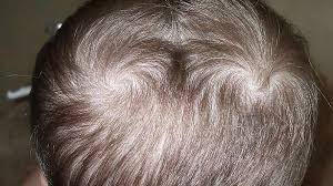 Double Crown Spiritual Meaning: Symbolism of Two Hair Whorls